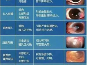 超级胬肉系统—超级胬肉系统：带来全新的眼部健康体验