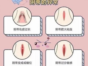 女人私密肥大？试试这款产品，找回紧致