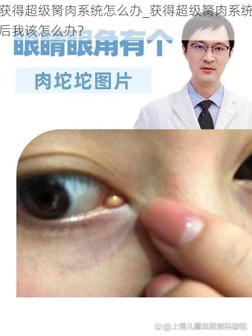 获得超级胬肉系统怎么办_获得超级胬肉系统后我该怎么办？