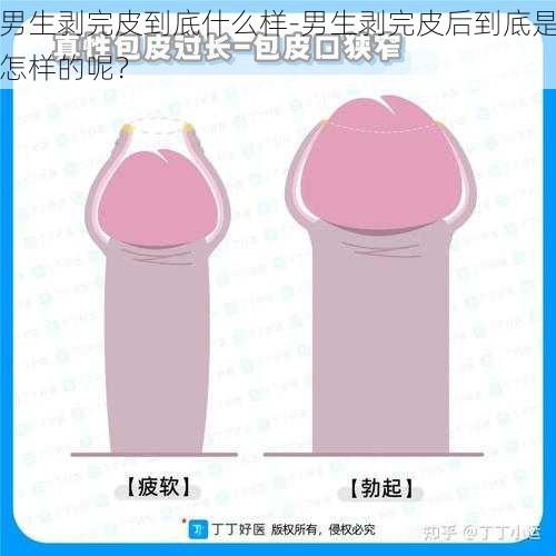 男生剥完皮到底什么样-男生剥完皮后到底是怎样的呢？