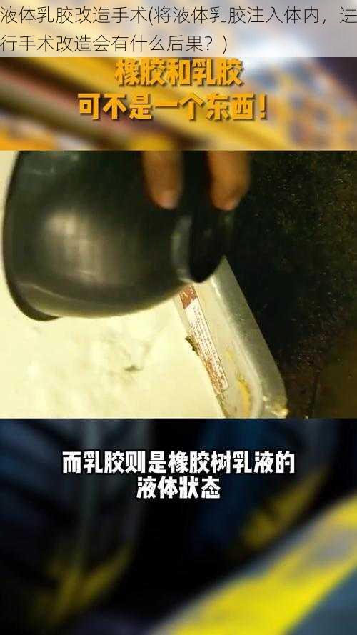 液体乳胶改造手术(将液体乳胶注入体内，进行手术改造会有什么后果？)